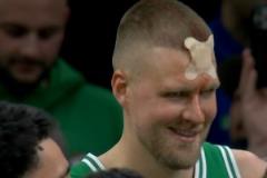 耐殺也不能這樣??！比塔澤鐵肘重?fù)舨ń蝾~頭 后者貼上可愛OK繃