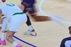 美國(guó)醫(yī)學(xué)專(zhuān)家：可以看到右小腿有震動(dòng) 這可能是跟腱撕裂的跡象